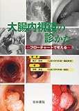 大腸内視鏡の診かた―フローチャートで考える