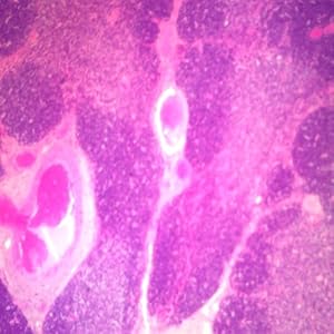 Human Spleen Microscope Slide, sec.