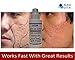 SILICON & COLLAGEN Topical Spray Acne Scars Facial Wrinkles & Age Blemishes 4 oz