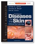 Andrews' Diseases of the Skin: Clinical Dermatology - Expert Consult - Online and Print, 11e (James, Andrew's Disease of the Skin)