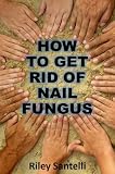 How to Get Rid of Nail Fungus