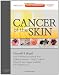 Cancer of the Skin: Expert Consult - Online and Print, 2e