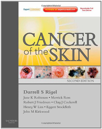 skin cancer