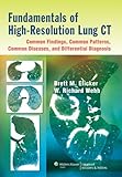 Fundamentals of high-resolution lung CT : common findings, common patterns, common diseases, and differential diagnosis