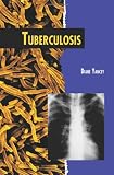 Tuberculosis (Twenty-First Century Medical Library)