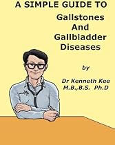 A Simple Guide to Gallstones and Gallbladder Diseases (A Simple Guide to Medical Conditions) A Simple Guide to Gallstones and Gallbladder Diseases (A Simple Guide to Medical Conditions)