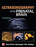 Ultrasonography of the prenatal brain