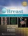 breast_cancer49breast cancer - Diseases of the Breast Diseases of the Breast