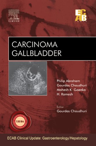 Carcinoma Gallbladder - ECAB