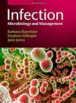 Infection: Microbiology and Management