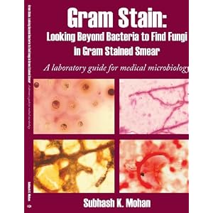 Click here to buy Gram Stain: Looking Beyond Bacteria to Find Fungi in Gram Stained Smear: A... by Subhash K. Mohan.