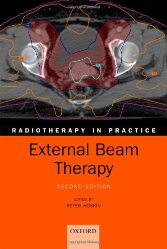 External Beam Therapy (Radiotherapy in Practice)