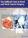 The Difficult Case in Head and Neck Cancer Surgery