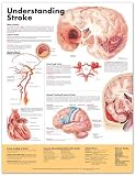 Chart - Understanding Stroke