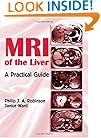 MRI of the Liver: A Practical