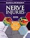Book Kline and Hudson's Nerve Injuries: Operative Results for Major Nerve Injuries, Entrapments and Tumors