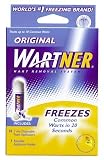 Wartner Wart Removal System - 1.18 fl oz