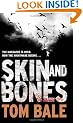 Skin and Bones