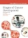 Stages of Cancer Development (The Biology of Cancer)