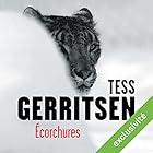 Écorchures (Rizzoli et Isles 11) | Livre audio Auteur(s) : Tess Gerritsen Narrateur(s) : Pierre-François Garel