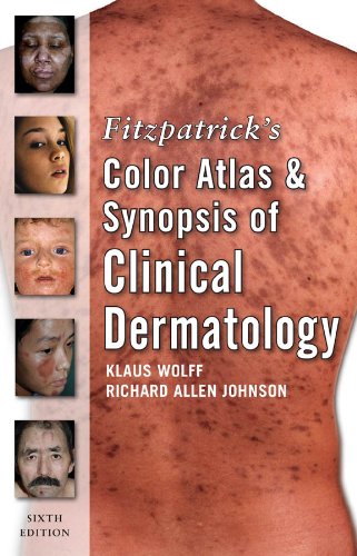 Fitzpatrick's Color Atlas and Synopsis of Clinical Dermatology