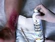 >wound wash saline 210ml. Wound Wash Saline