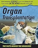 Organ transplantation