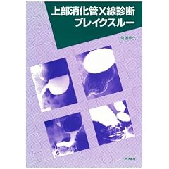 �㕔������X���f�f�u���C�N�X���[