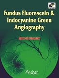 Fundus Fluorescein and Indocyanine Green Angiography