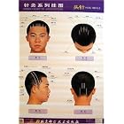 Series Chart of Acupuncture: Head Needle by  Wang Fuchun