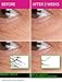Venin Royale - Snake Venom Anti-Aging and Anti-Wrinkle Peptide Serum for Fine Lines, Rosacea, Uneven Tone | Best Skin Care for Face, Hands & Neck | Neuropeptide Treatment & Botox Cream