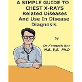 A Simple Guide to Chest X-rays, Related Diseases and Use in Disease Diagnosis (A Simple Guide to Medical Conditions)