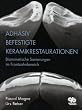 Adh�siv befestigte Keramikrestaurationen: Biomimetische Sanierungen im Frontzahnbereich