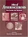 Atlas of Atherosclerosis: Risk Factors and Treatment