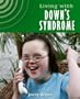 Living With Downs Syndrome