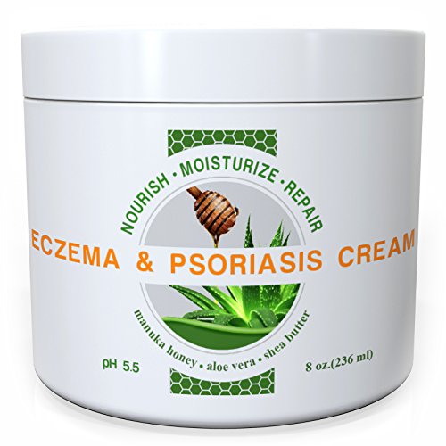 Natural Eczema & Psoriasis Treatment Moisturizer Skin Cream By Wild Naturals - With Manuka Honey and Aloe Vera - Also For Dermatitis, Acne & Rosacea - Very Light, Non-greasy, Absorbs Quickly - All the Nutrients Your Skin Needs - For All Skin Types - Relieves Dry, Red, Irritated, Itchy & Cracked Skin - Restores Skin's Natural Moisture Balance - Satisfaction Guaranteed