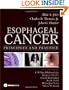 Esophageal Cancer: Principles and Practice