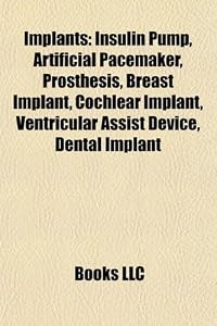 Implants: Insulin Pump, Artificial Pacemaker, Prosthesis, Breast Implant, Cochlear Implant, Ventricular Assist Device, Dental Implant
