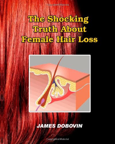 female hair loss