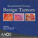 Musculoskeletal Oncology: Benign Tumors