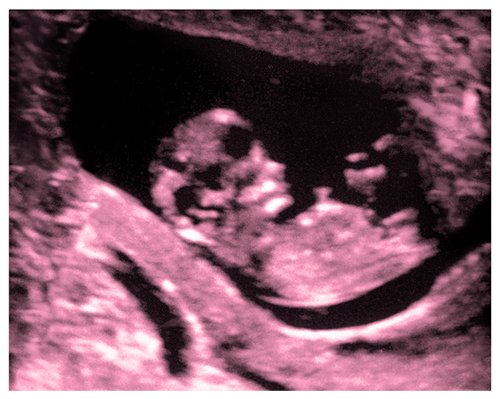 Ultrasounds Of Boys. (Pink) oys summer clothes