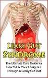 Leaky Gut Syndrome: The Ultimate Cure Guide for How to Fix Your Leaky Gut Through A Leaky Gut Diet (Leaky Gut Syndrome, Leaky Gut Diet)
