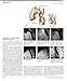 The Netter Collection of Medical Illustrations: Cardiovascular System: Volume 8 (Netter Green Book Collection)