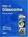 Book Atlas of Glaucoma, Second Edition (Softcover Special Edition)