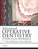 Advanced operative dentistry : a practical approach