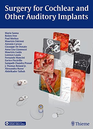 Surgery for Cochlear and Other Auditory Implants, by Mario Sanna, Paul Merkus, Rolien H. Free, Maurizio Falcioni Surgery for Cochlear and Other Auditory Implants, by Mario Sanna, Paul Merkus, Rolien H. Free, Maurizio Falcioni