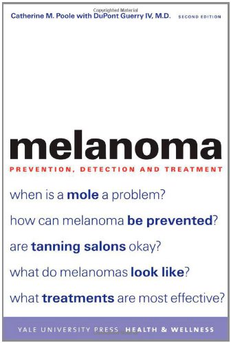 melanoma