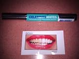 Celebrity Whites On The Go Advanced Teeth Whitening system 51r7tVLMLpL. SL160 Celebrity Whites On The Go Advanced Teeth Whitening system