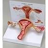 Uterus Ovary Anatomical Model With Pathologies
