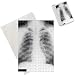 Photo Jigsaw Puzzle of Normal Adult Chest X-Ray PA View from Cmsp